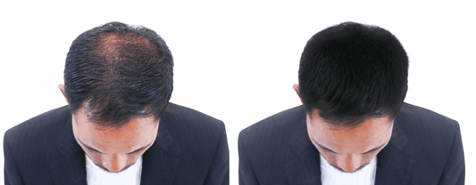 Strengthen and Grow Your Hair